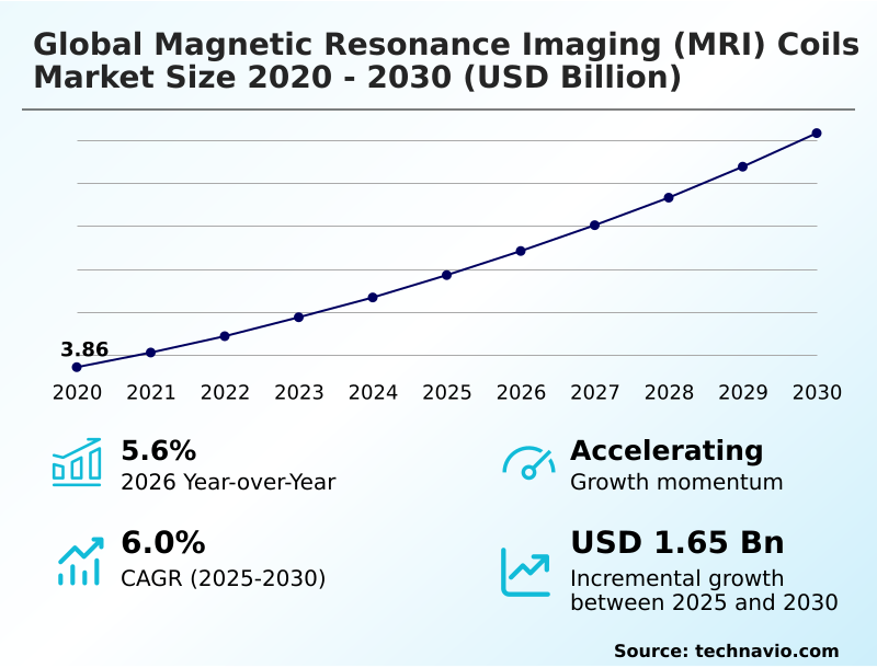 Foundry Equipment Market Sizeeeeee