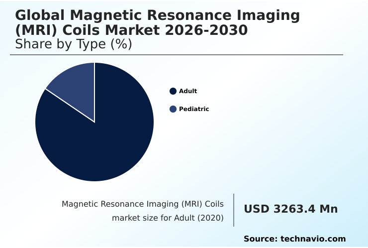 Foundry Equipment Market Size