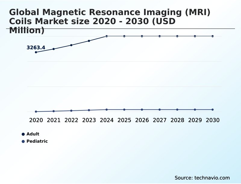 Foundry Equipment Market Size