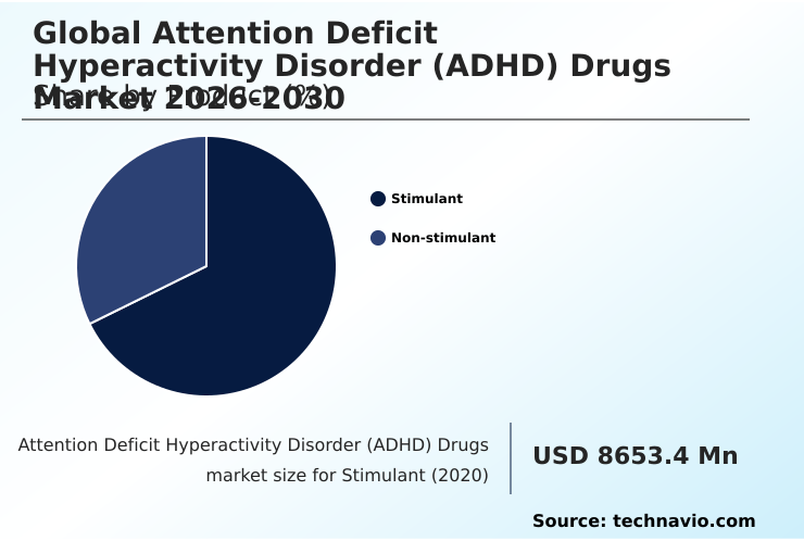 Foundry Equipment Market Size