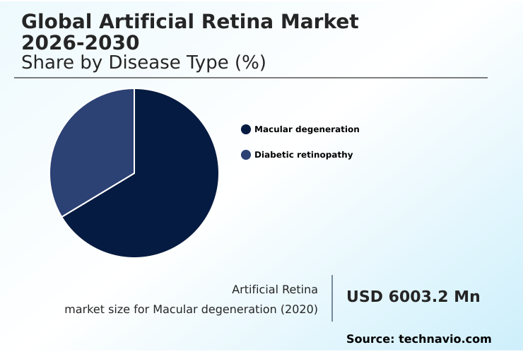 Foundry Equipment Market Size