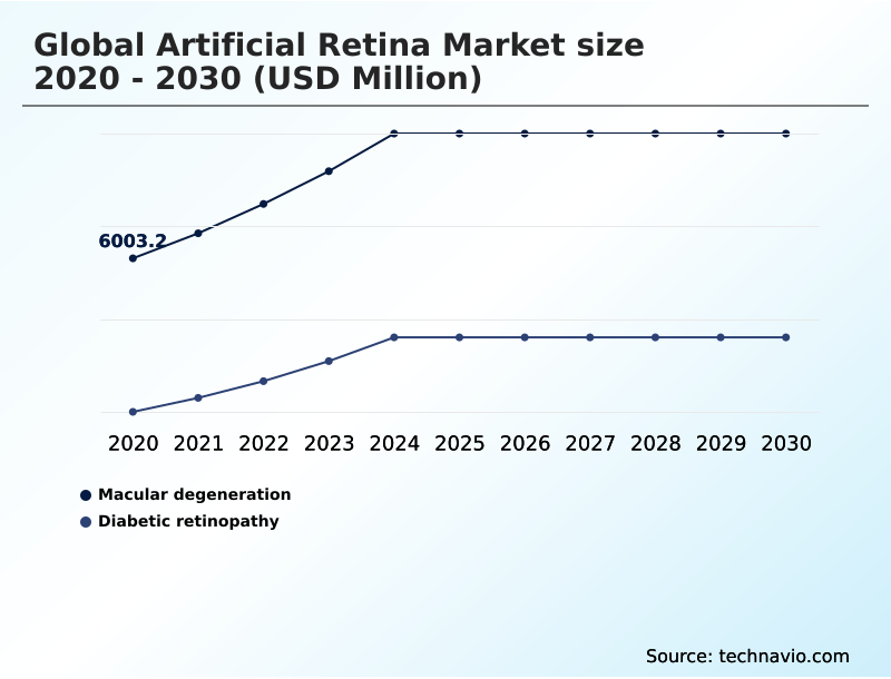 Foundry Equipment Market Size