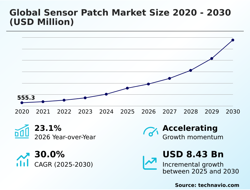 Foundry Equipment Market Size