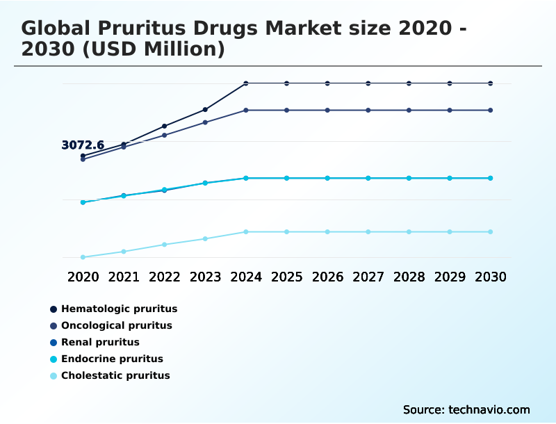 Foundry Equipment Market Size