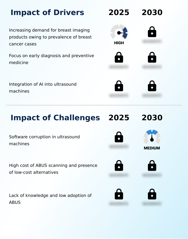 Foundry Equipment Market Size
