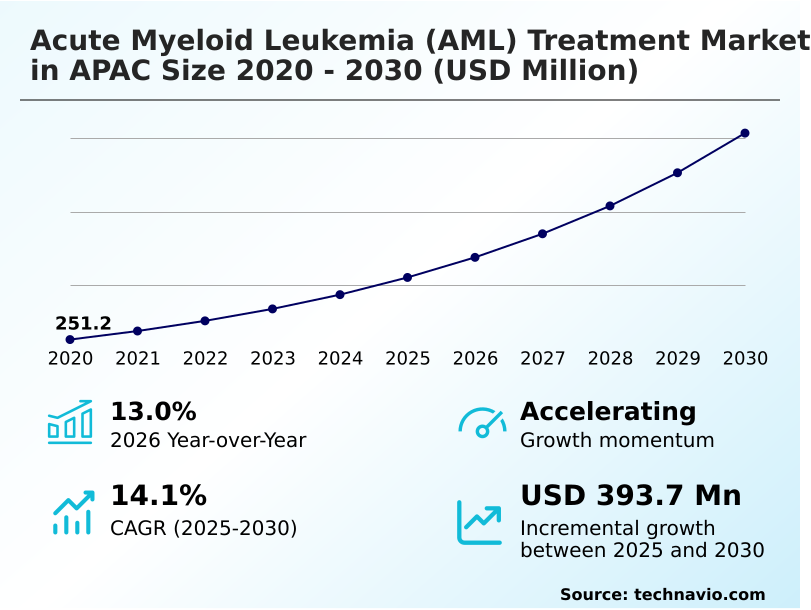 Foundry Equipment Market Sizeeeeee