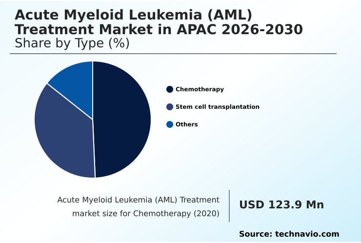 Foundry Equipment Market Size
