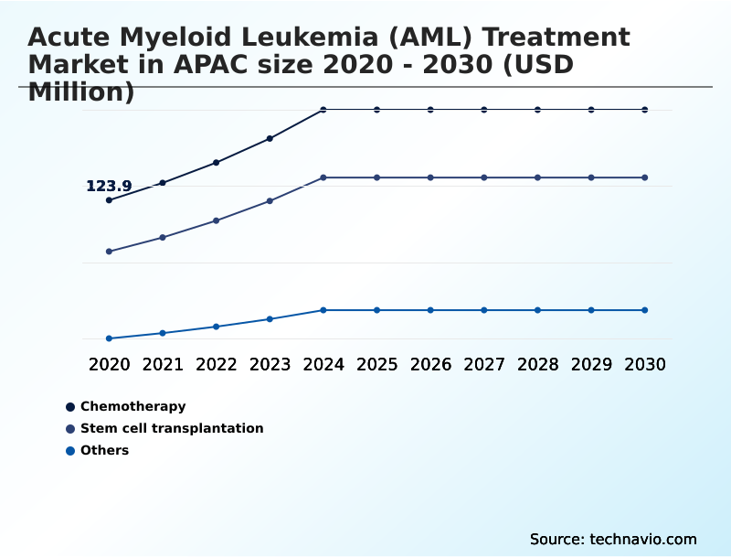 Foundry Equipment Market Size