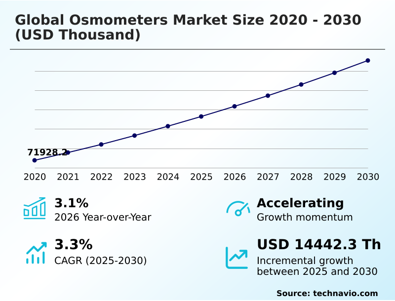Foundry Equipment Market Size
