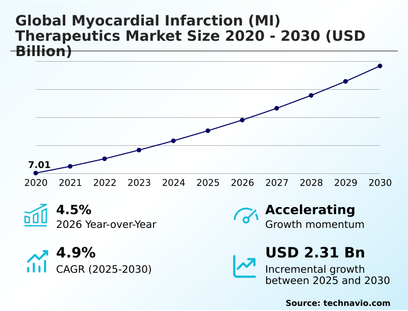 Foundry Equipment Market Sizeeeeee