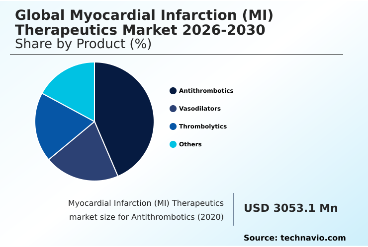 Foundry Equipment Market Size