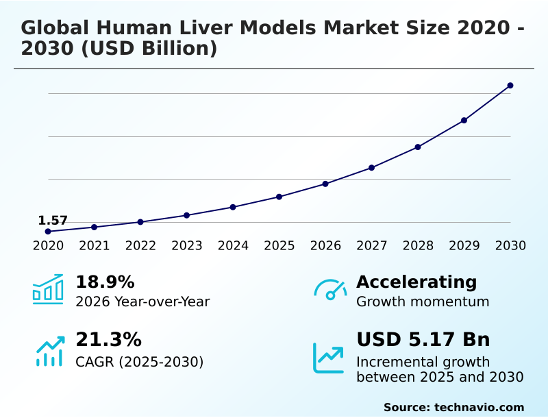 Foundry Equipment Market Size