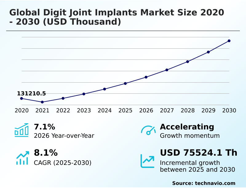 Foundry Equipment Market Size