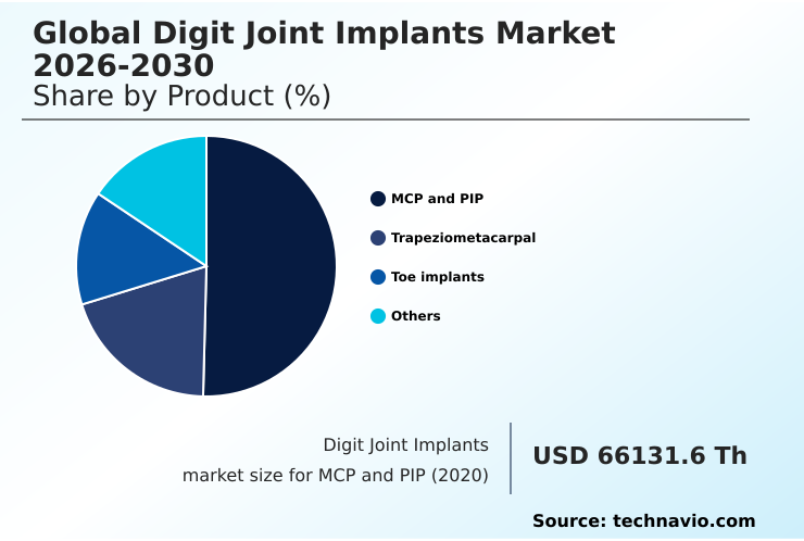 Foundry Equipment Market Size