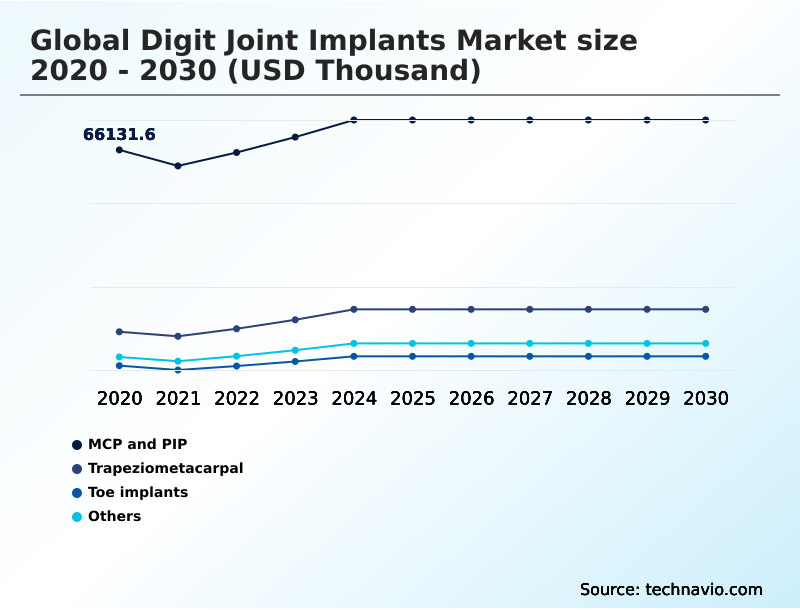 Foundry Equipment Market Size
