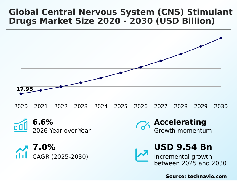 Foundry Equipment Market Size