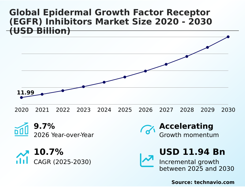Foundry Equipment Market Size