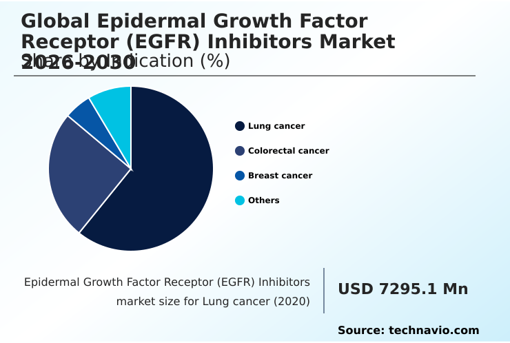 Foundry Equipment Market Size