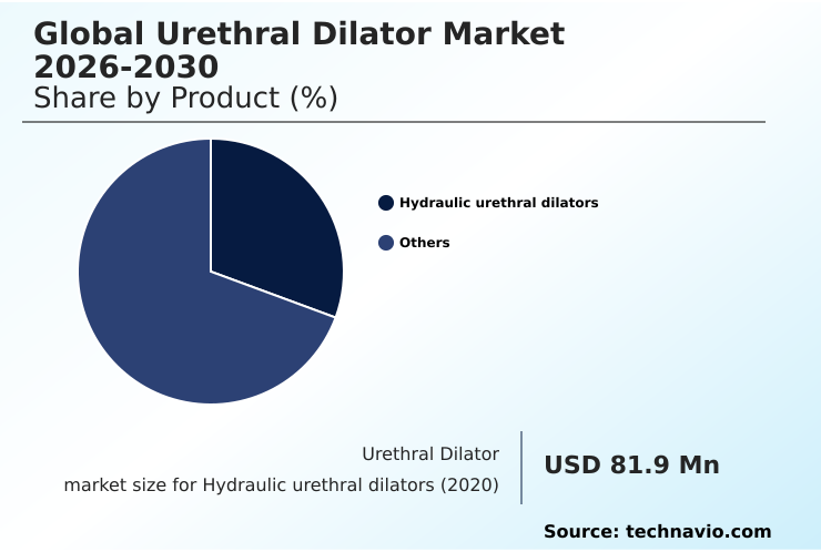 Foundry Equipment Market Size