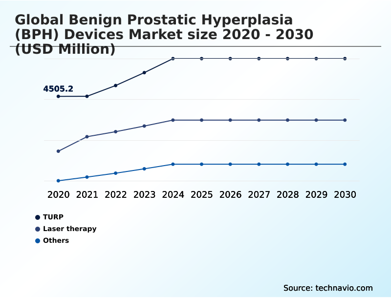 Foundry Equipment Market Size