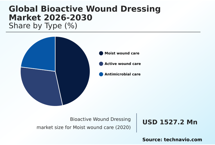 Foundry Equipment Market Size