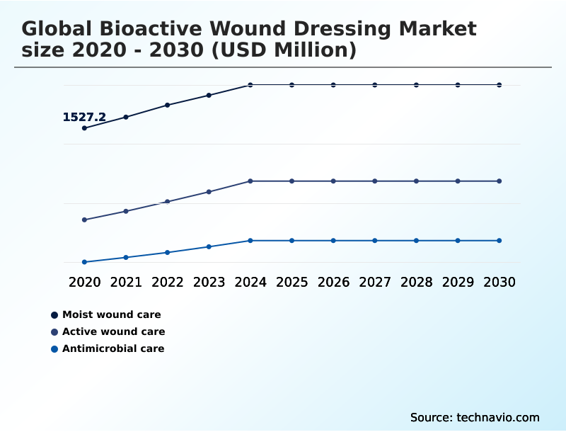 Foundry Equipment Market Size