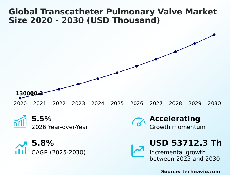 Foundry Equipment Market Size