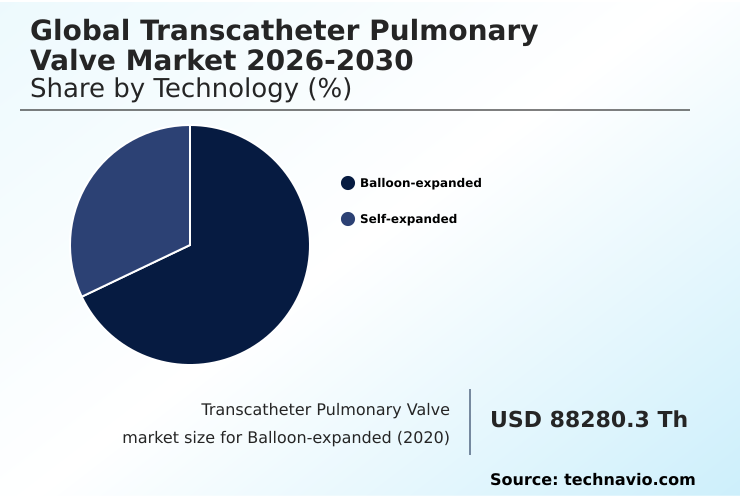 Foundry Equipment Market Size