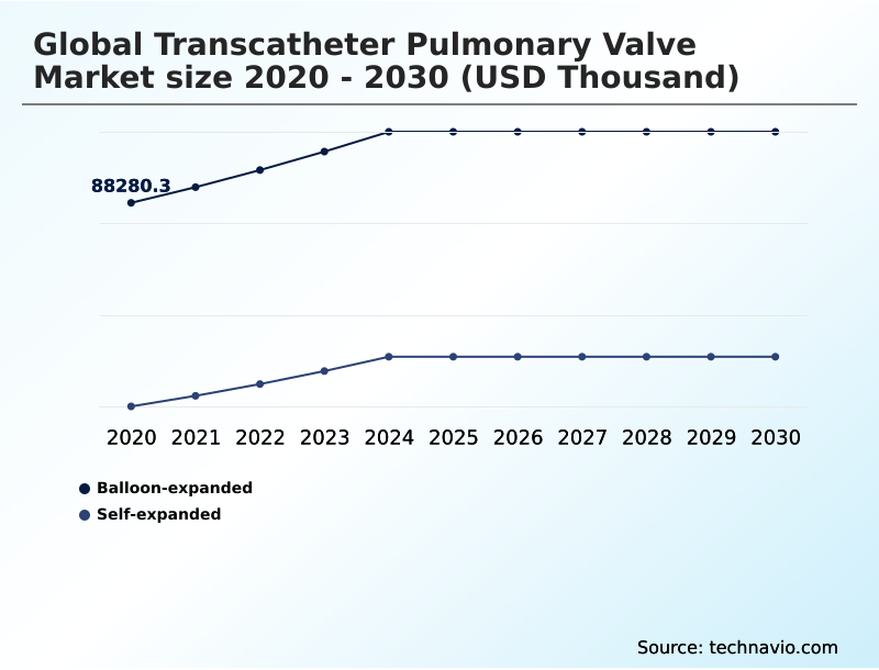 Foundry Equipment Market Size