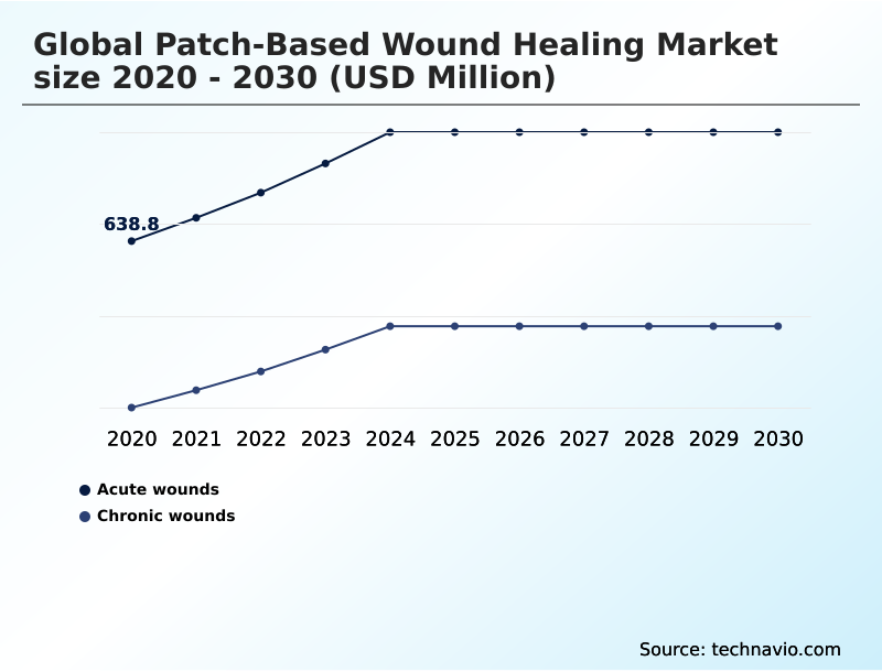 Foundry Equipment Market Size