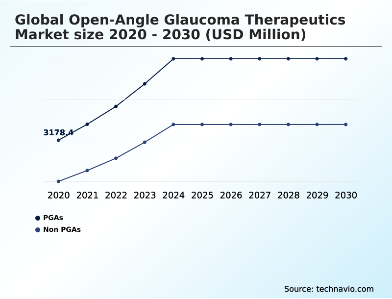Foundry Equipment Market Size