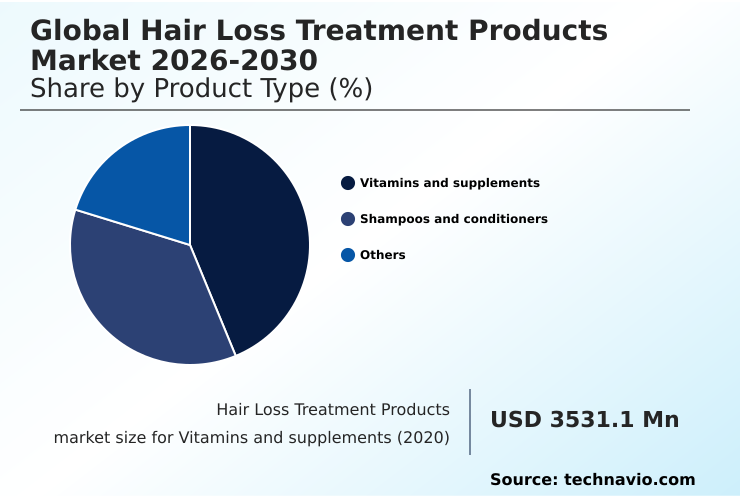 Foundry Equipment Market Size
