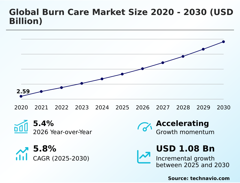 Foundry Equipment Market Sizeeeeee