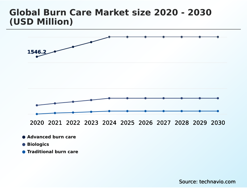 Foundry Equipment Market Size