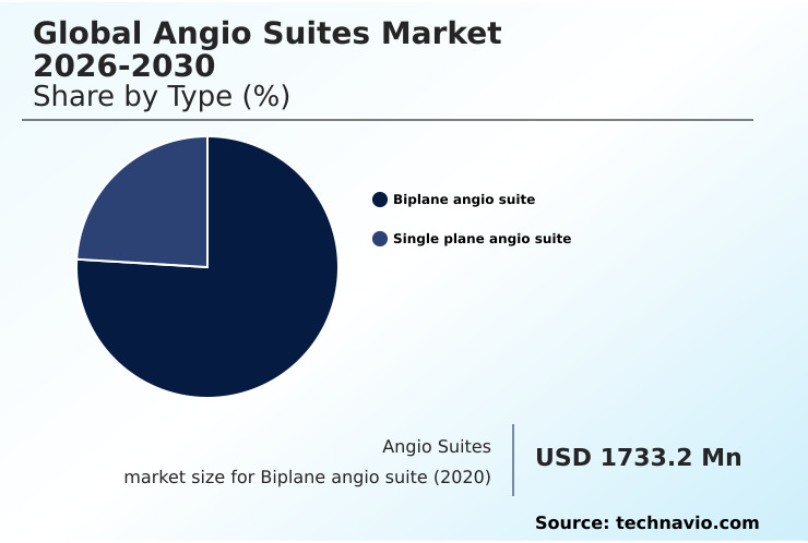 Foundry Equipment Market Size