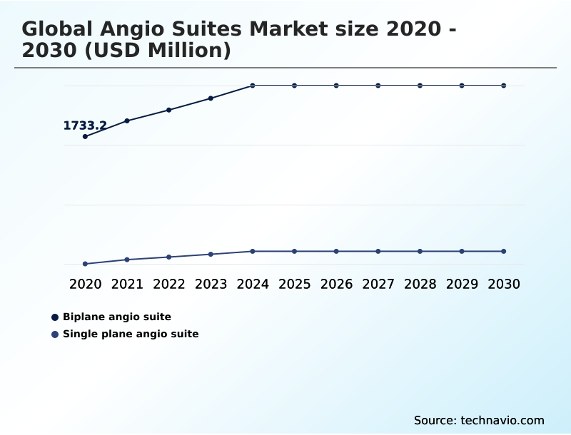 Foundry Equipment Market Size