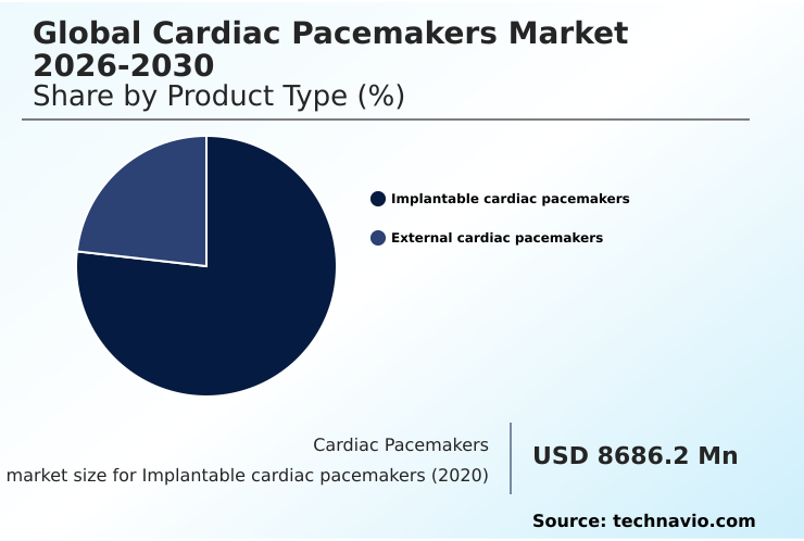 Foundry Equipment Market Size