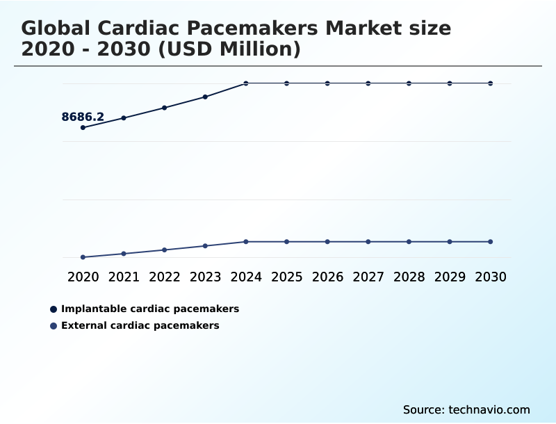 Foundry Equipment Market Size