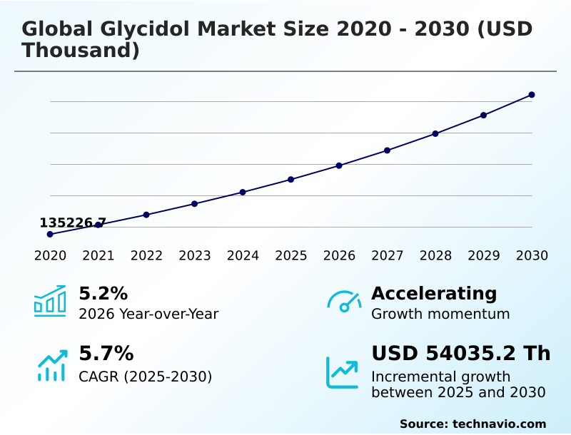 Foundry Equipment Market Sizeeeeee