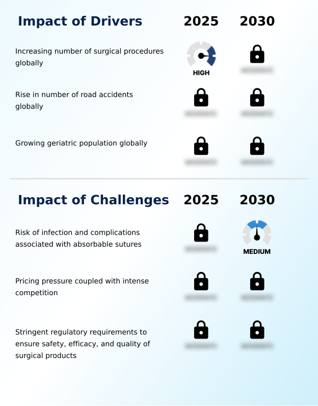 Foundry Equipment Market Size