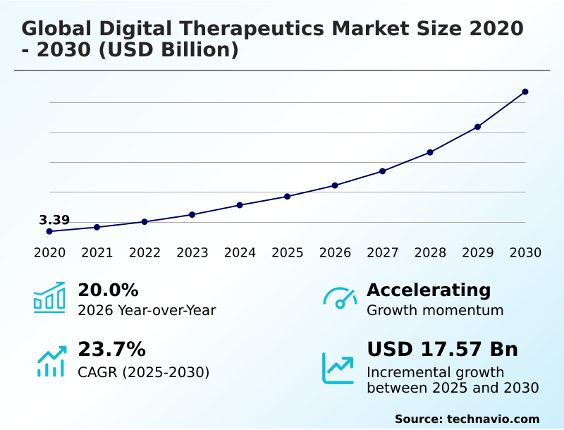 Foundry Equipment Market Sizeeeeee