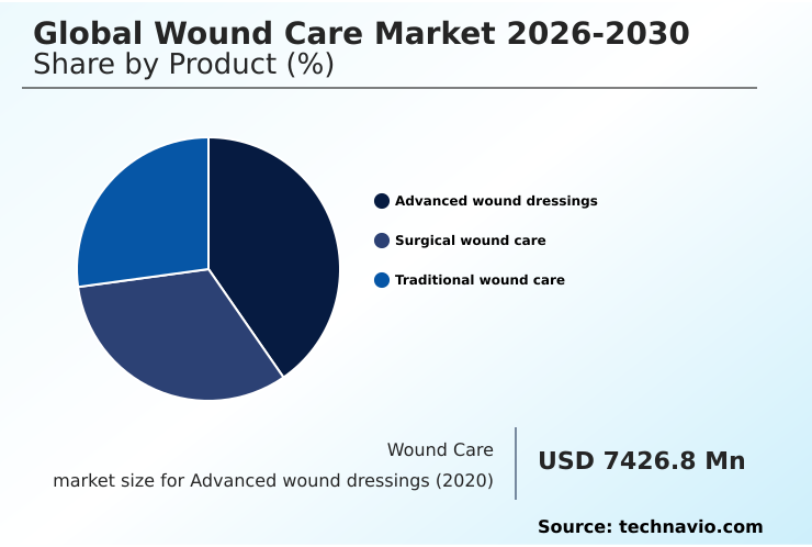 Foundry Equipment Market Size
