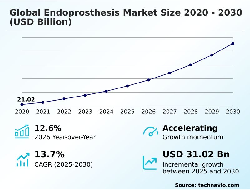 Foundry Equipment Market Sizeeeeee
