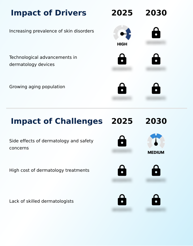 Foundry Equipment Market Size