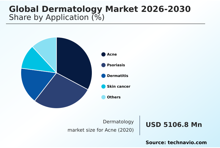 Foundry Equipment Market Size