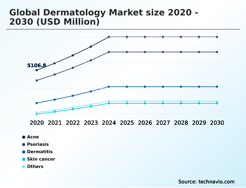Foundry Equipment Market Size