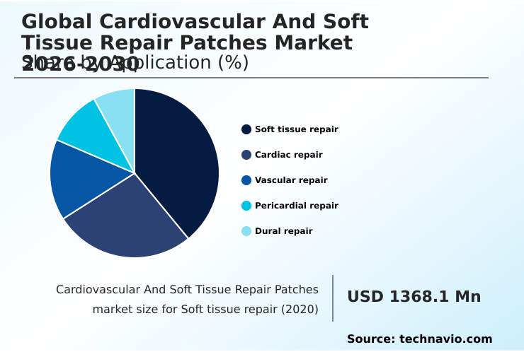 Foundry Equipment Market Size