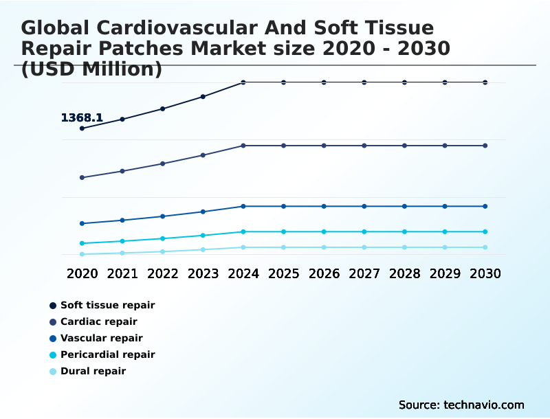 Foundry Equipment Market Size