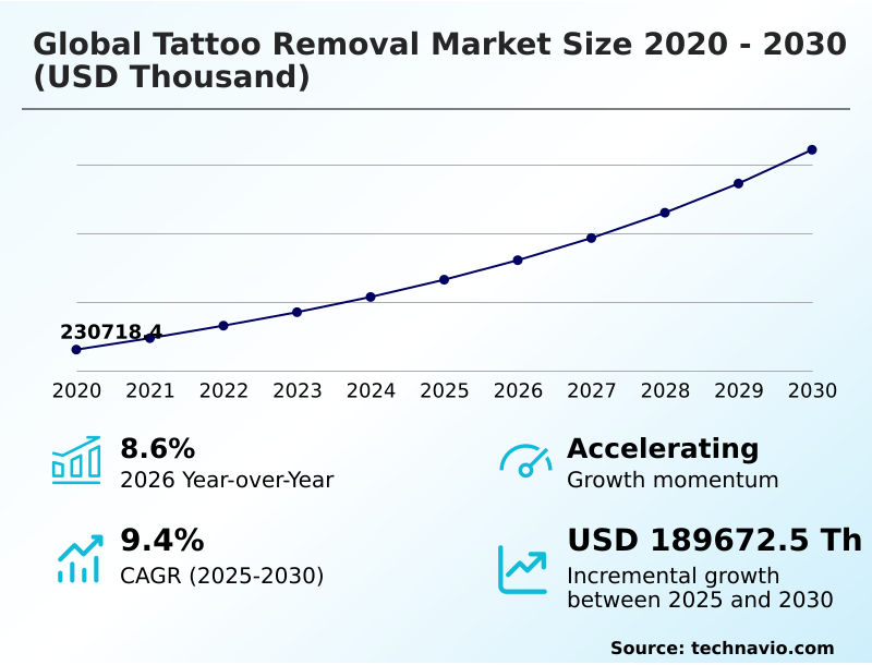 Foundry Equipment Market Size