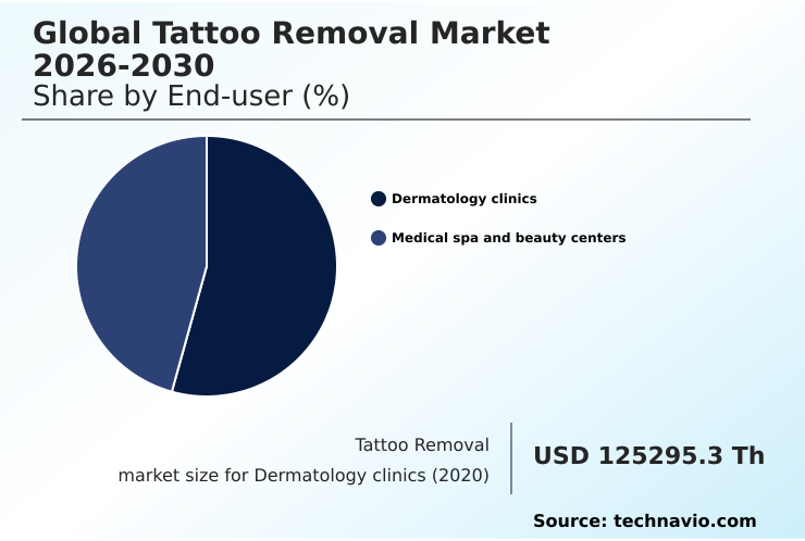 Foundry Equipment Market Size